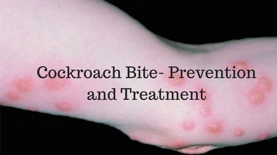 Cockroach Bite Prevention and Treatment